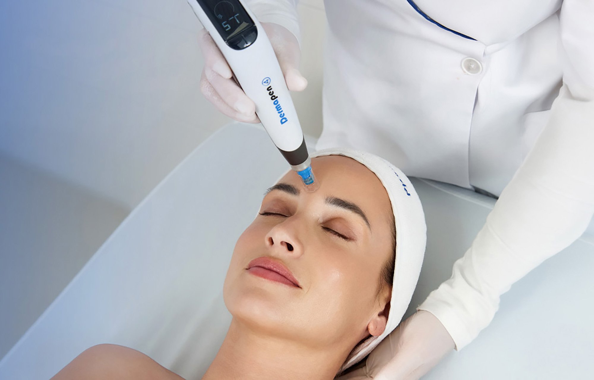 Dermapen 4 Patient Treatment 02